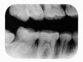 Películas de rayos X dentales